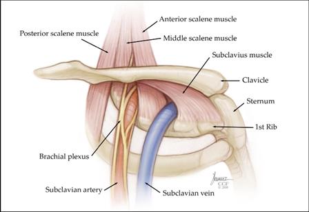 Thoracic Outlet Syndrome (TOS) Type, Cause, Treatment, Exercise