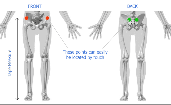 How Do You Measure For a Leg Length Discrepancy (LLD)? — ChiroUp