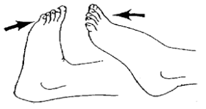 Ankle Range Of Motion Exercise Active Active Assisted Passive Exercise