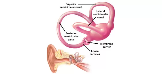 Vertigo Anatomy