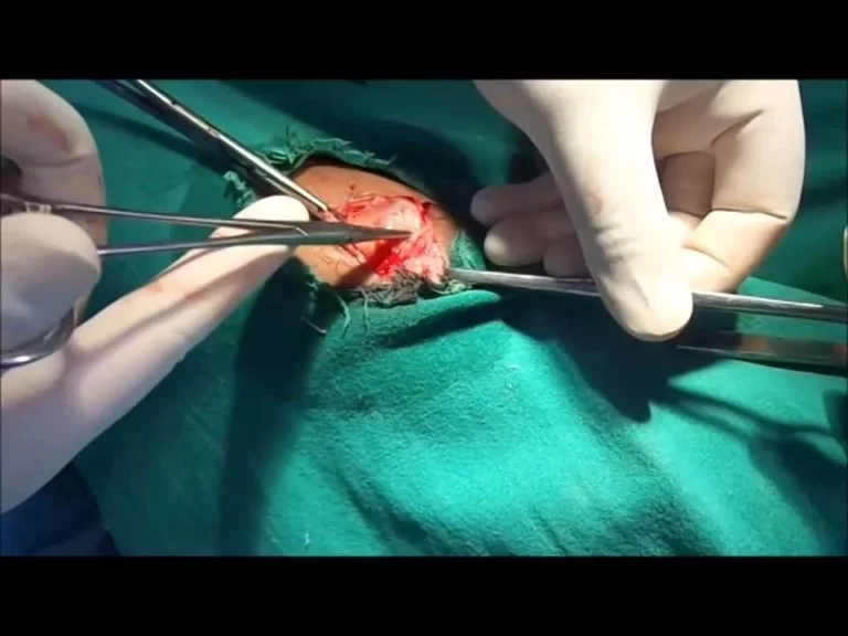 surgical treatment
