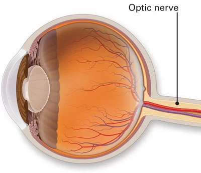 optic nerve