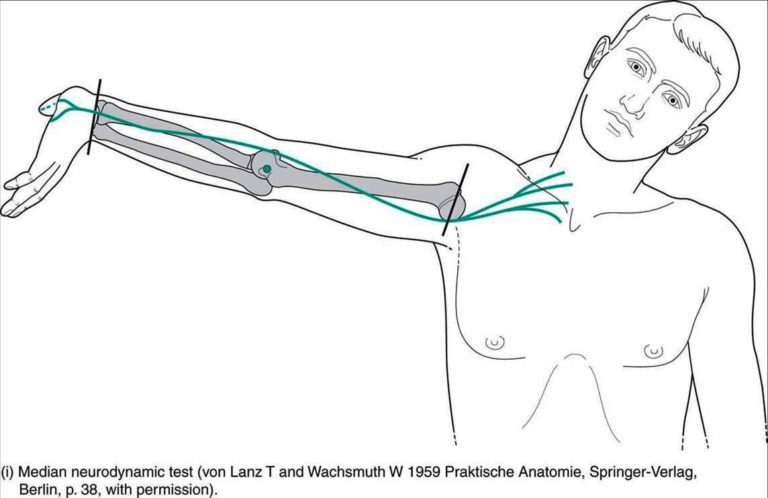 Upper Limb Tension Test