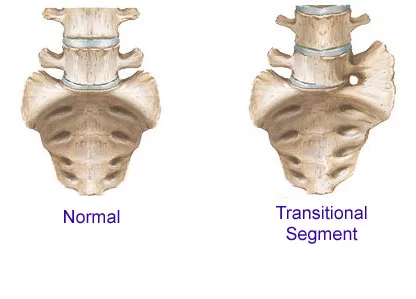 Sacralization