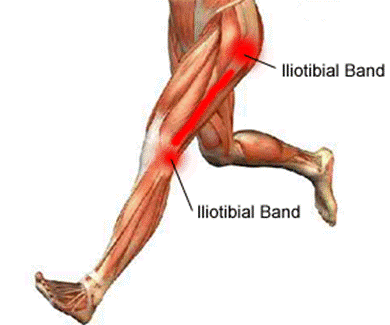 KT Tape Tutorial - IT Band  The IT Band, or iliotibial band, is a thick  band of fibrous tissue that runs down the outside of the leg. The  iliotibial band begins