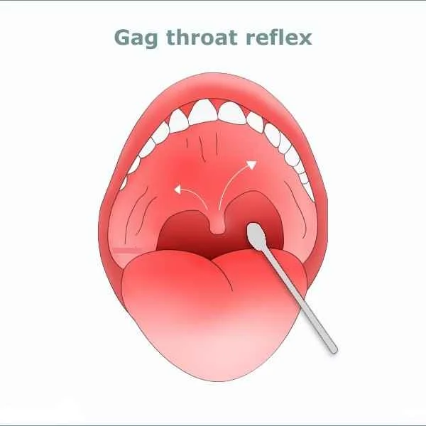 Gag Throat Reflex