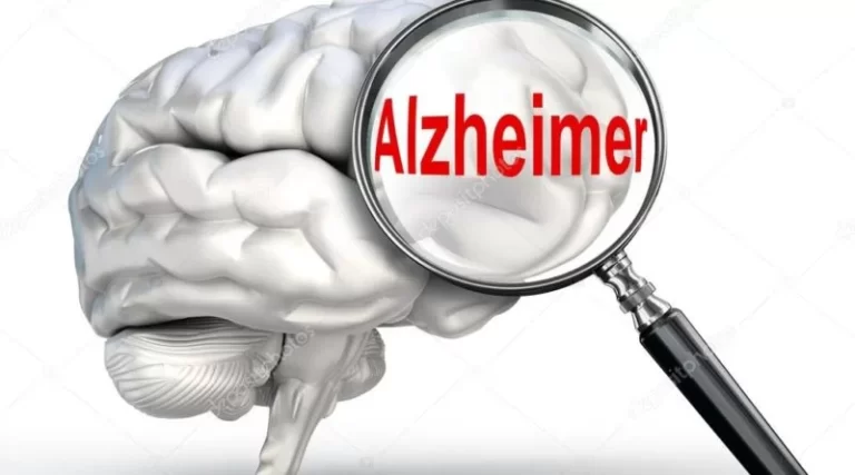 Alzheimer’s disease