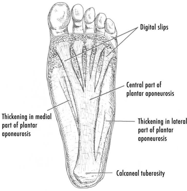 plantar-fasciitis-cause-symptoms-treatment-exercise