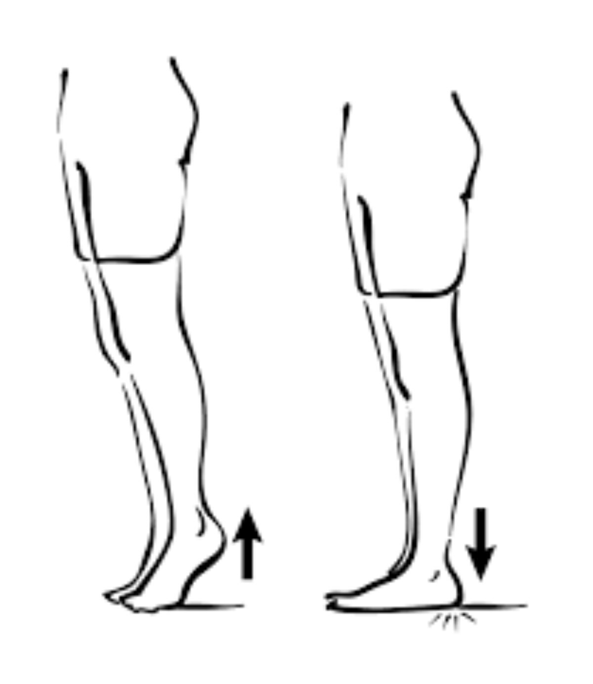 Heel-raise-lower exercise on a block through full range of ankle... |  Download Scientific Diagram