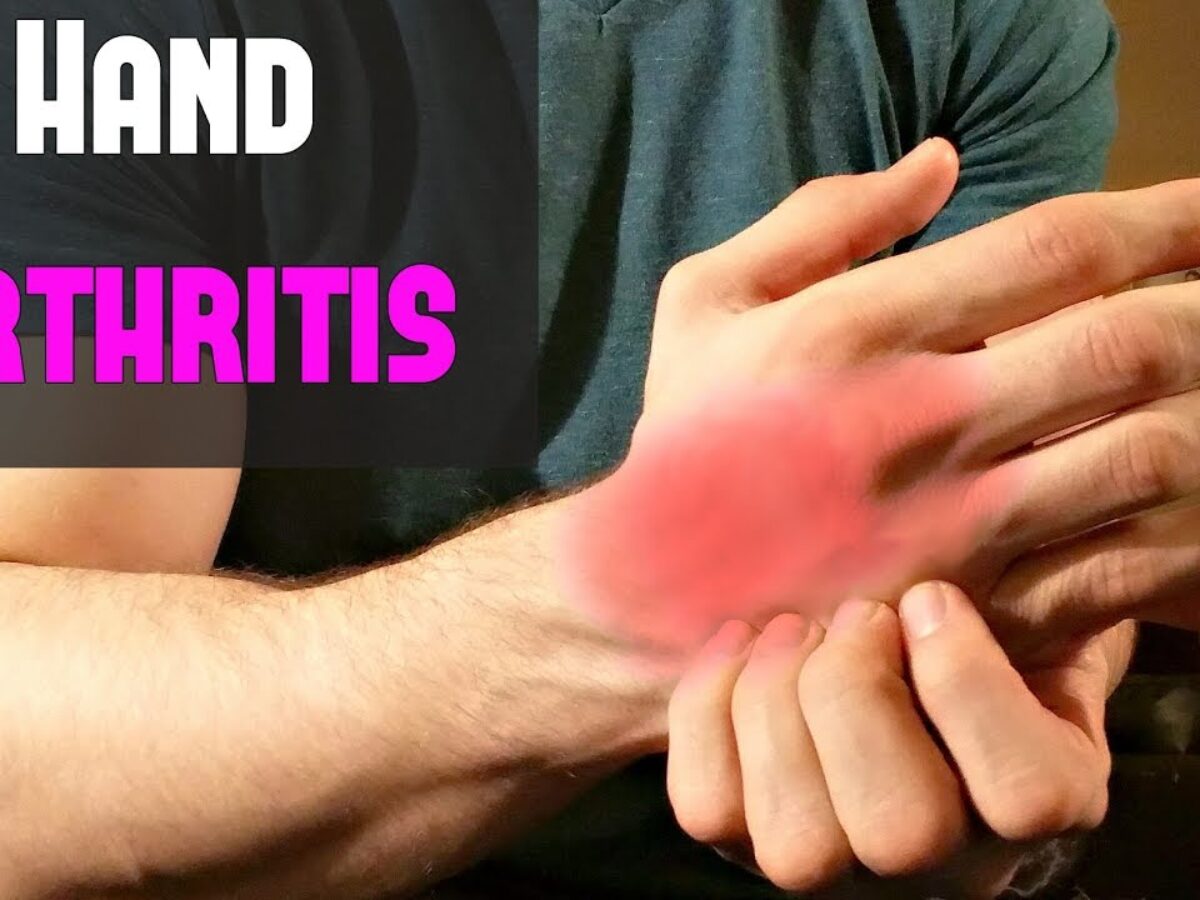 Adaptive Tools for Arthritis-Afflicted Hands