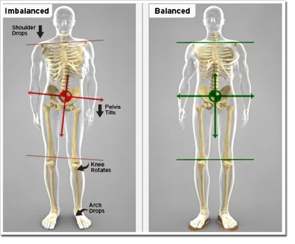 How to Measure and Fix a Leg Length Discrepancy 