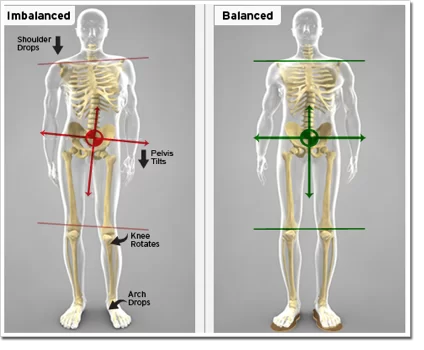 Leg Length Discrepancy 