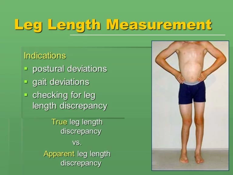 true leg length discrepancy test