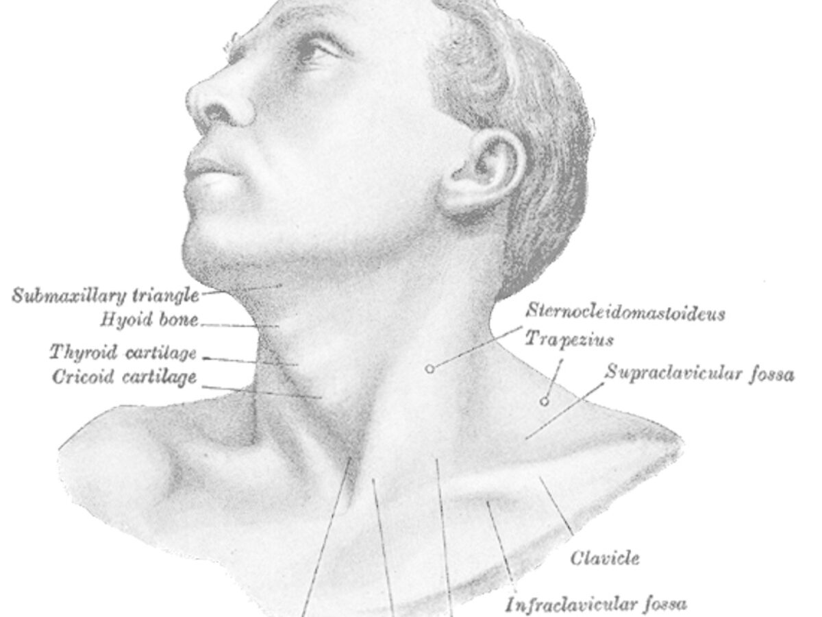 cervical dystonia