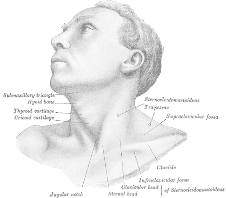 torticollis of the neck