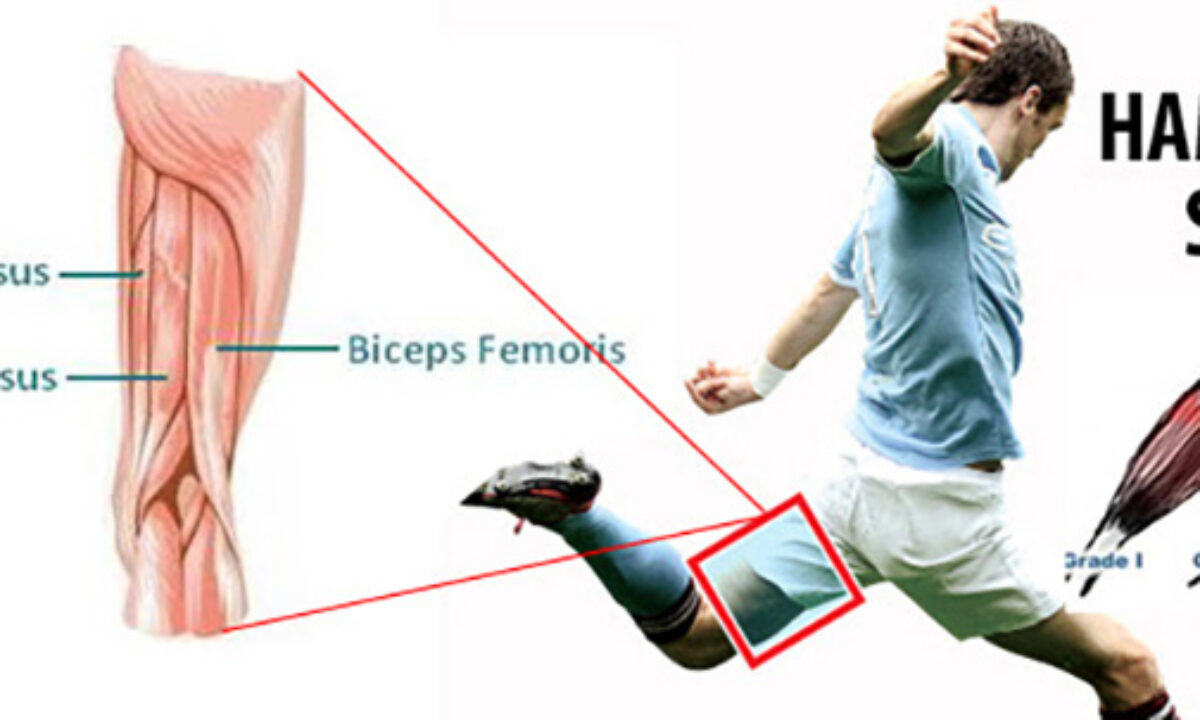 Hamstring Strain Injuries - Heel Sliders - InSync Physiotherapy