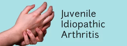 Juvenile arthritis - Cause, Symptoms, Diagnosis, Treatment