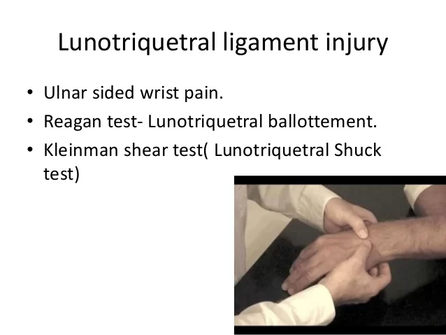Lunotriquetral-ballotement-test