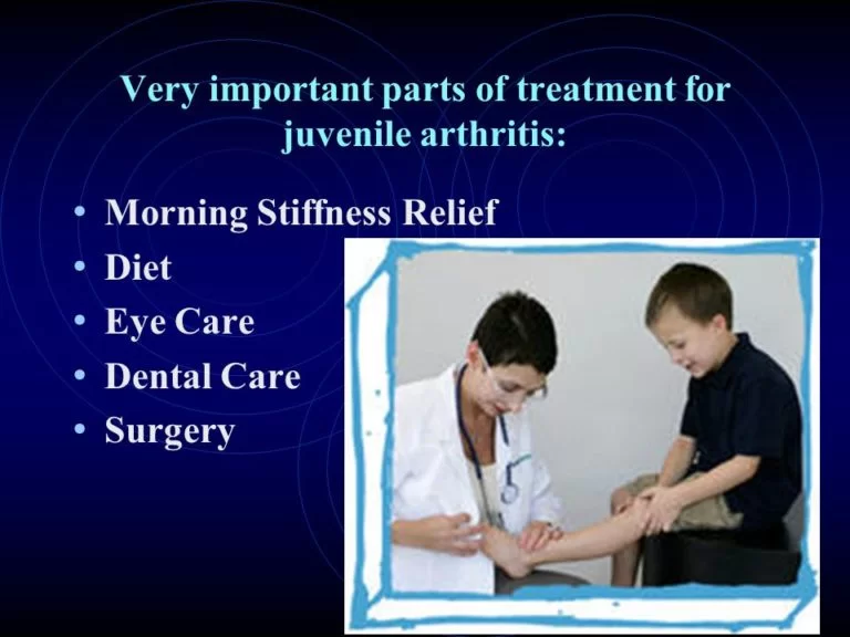 Physiotherapy Treatment Of Juvenile Arthritis