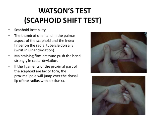 Scaphoid Watson shift test
