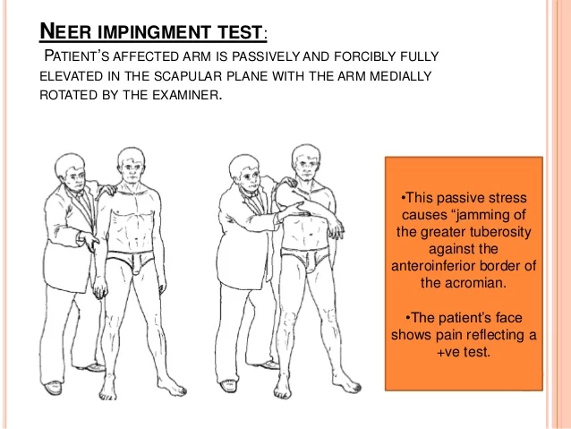 Scapula Bone - Surfaces, Attachments, Biomechanics - Samarpan