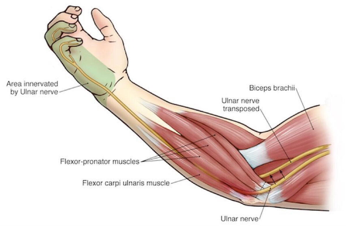 Ulnar Nerve (Human Anatomy): Image, Functions, Diseases and Treatments