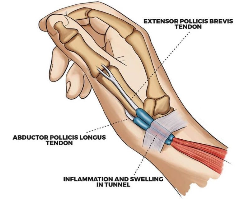 WRIST JOINT - Samarpan Physiotherapy Clinic