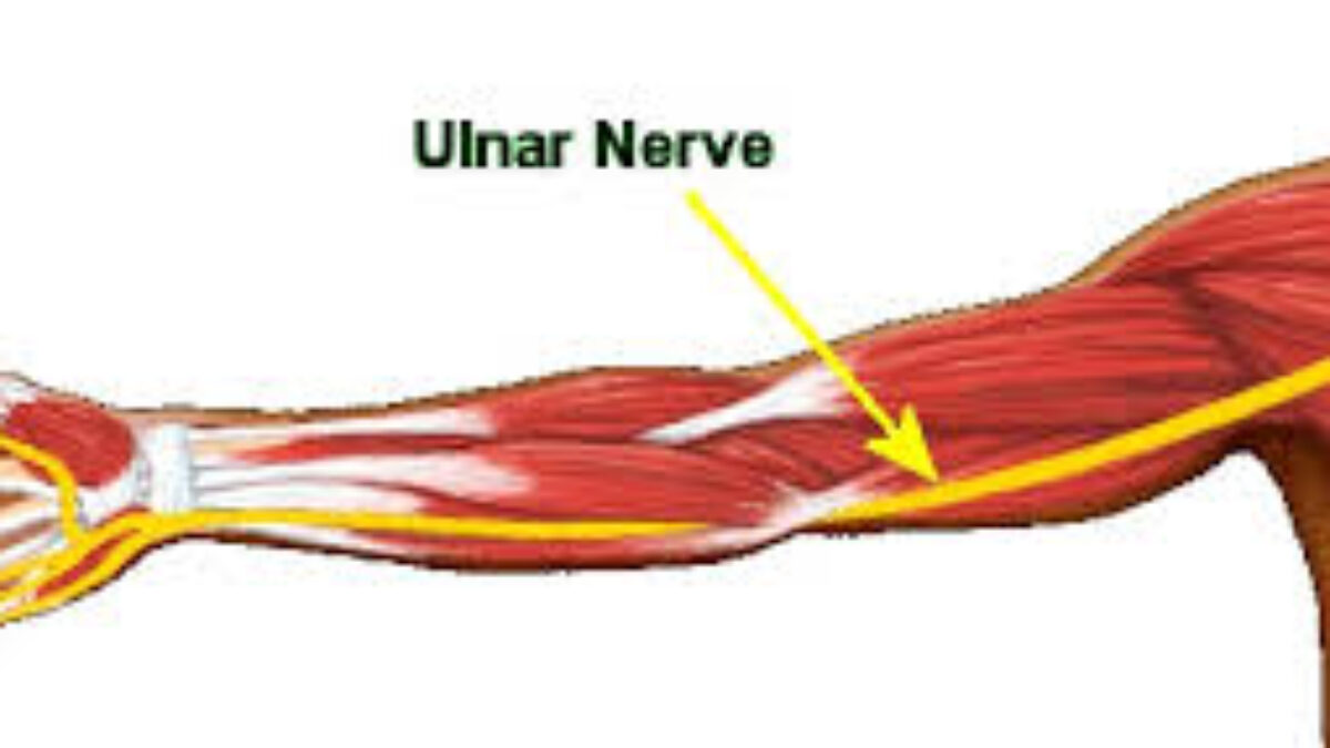 Ulnar Nerve Root Compression Symptoms & Treatments