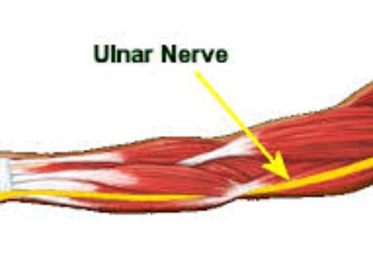ulnar nerve palsy