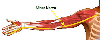 Ulnar Nerve Palsy