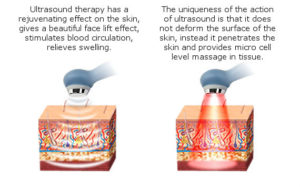 Ultrasonic therapy machine: Types, Effects, Indications