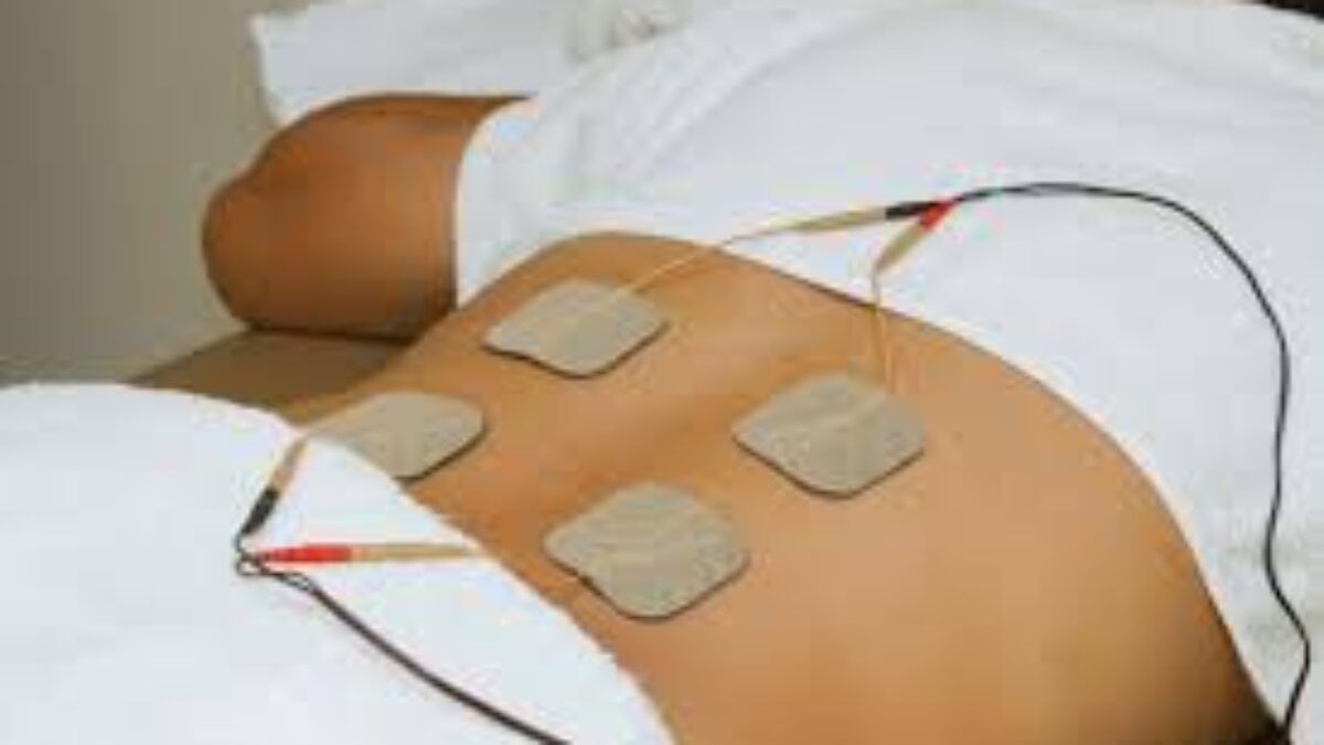 Types of Electrical Stimulation in Physical Therapy