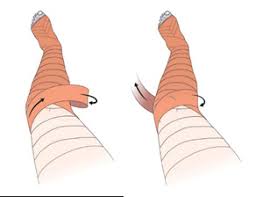 CREPE BANDAGE FOR LOWER LIMB