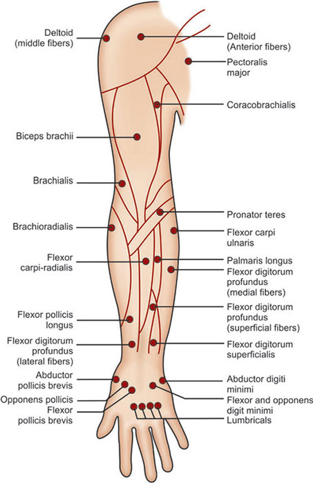 Muscle Stimulator (MS) Explained, Faradic & Galvanic uses, 