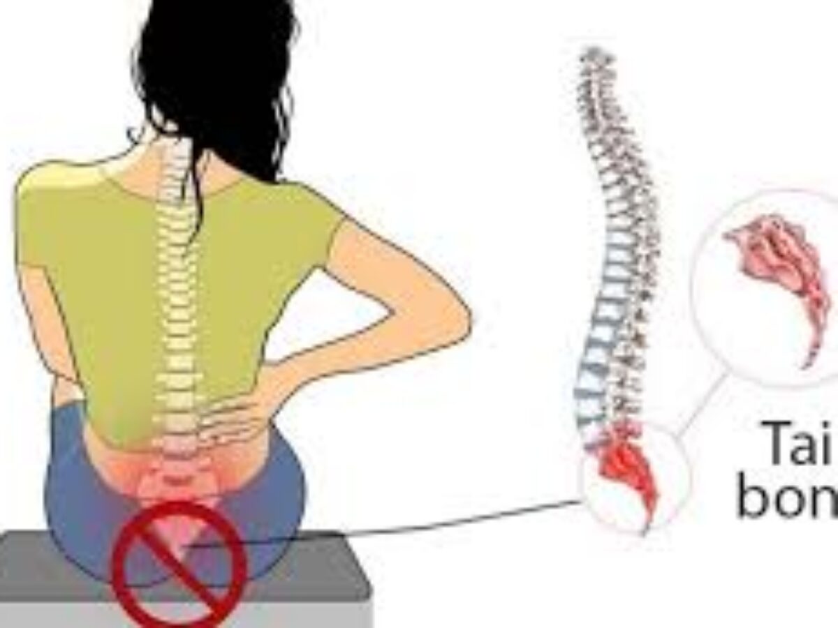 Tailbone Pain and Sitting: Managing and Treating Coccydynia Part 2-  Hormones Matter