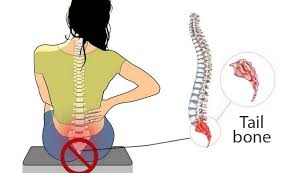 Coccygodynia Coccydynia Coccalgia Tailbone Pain Samarpan Physiotherapy Clinic Ahmedabad