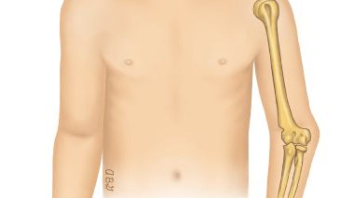 Gunstock Deformity - Cause, Symptoms, Treatment