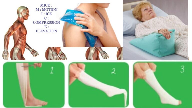 PRICE Principles For Injury - is importance for injury on primary