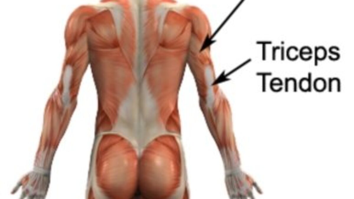 Triceps Brachii Muscle Pain - The Wellness Digest