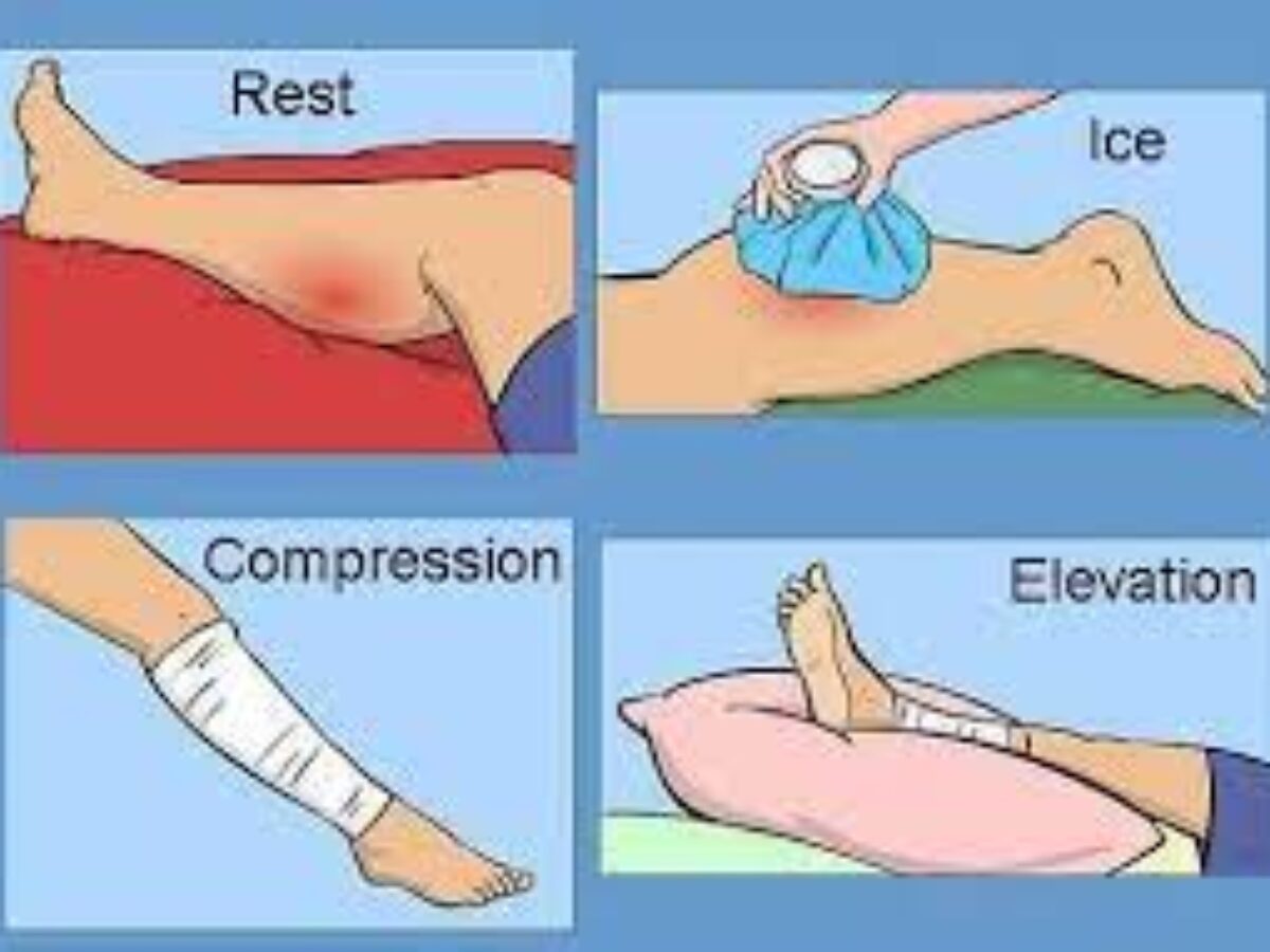 West 1 Physiotherapy and Pilates - Ankle sprain treatment tips from  @physiotherapy_19 Treatment:- try the “RICE” method to ease your symptoms.  RICE stands for “rest, ice, compress, and elevate.” Here's how it