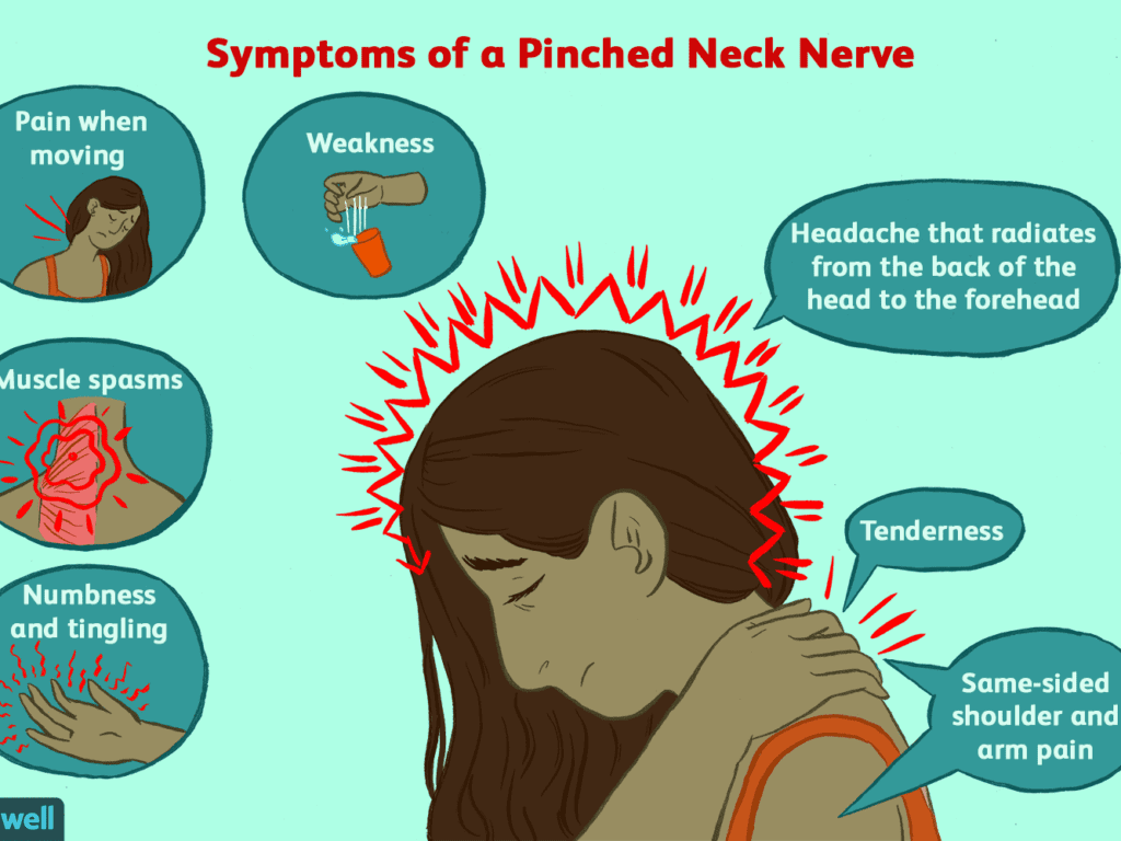 Symptoms of cervicogenic headache