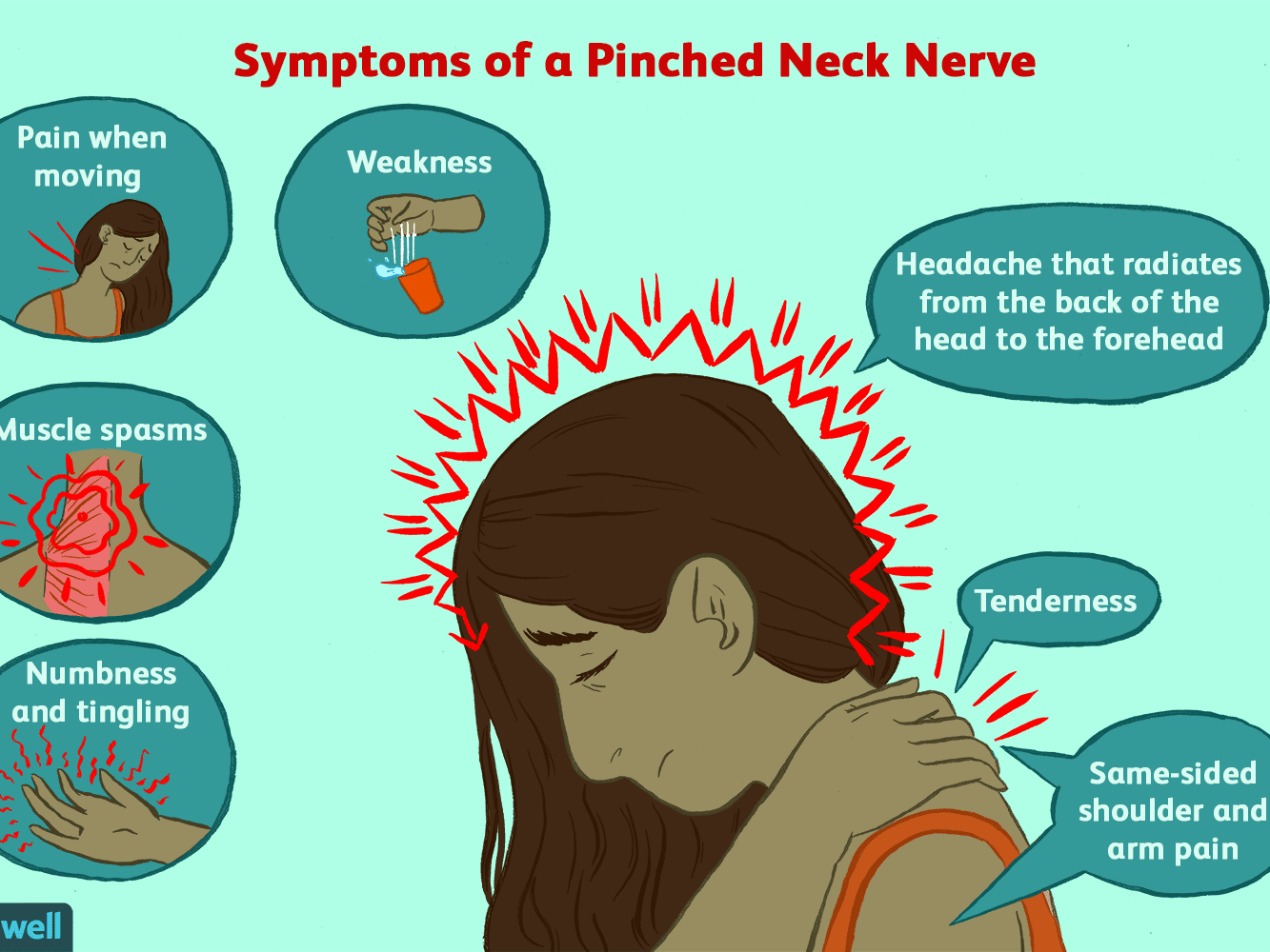 Cervicogenic Headache Cause Symptoms Physiotherapy Treatment