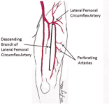 Tensor fasciae latae tightness : Cause, Symptom's, Stretching Exercise