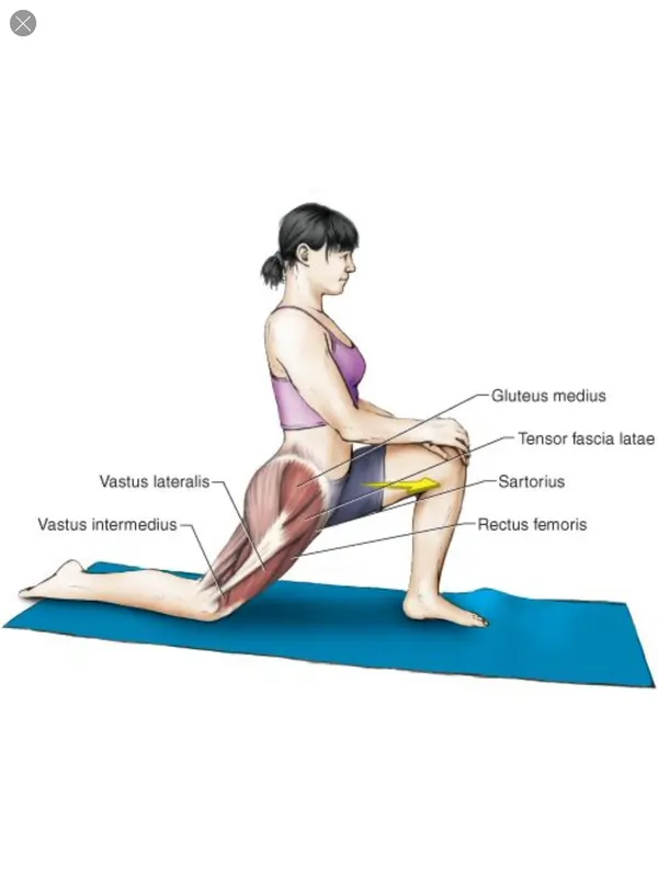 Quadriceps muscle Tightness