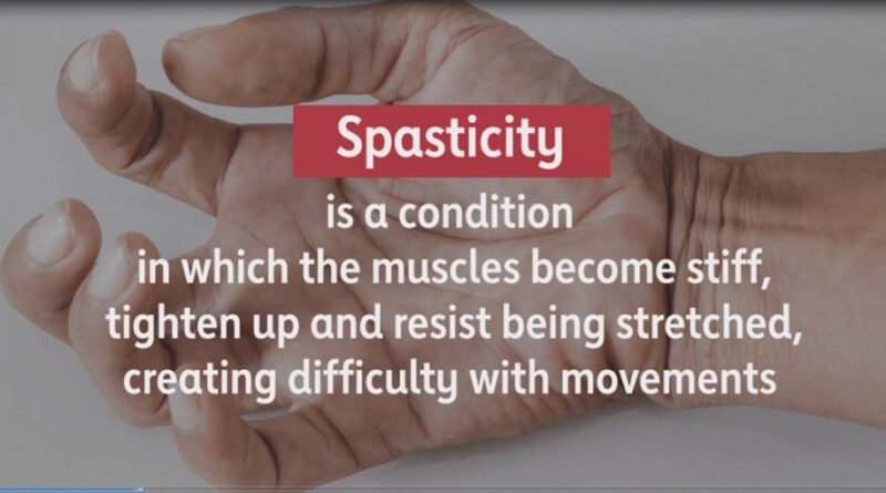 How To Reduce Spasticity In Hand Archives Samarpan Physiotherapy