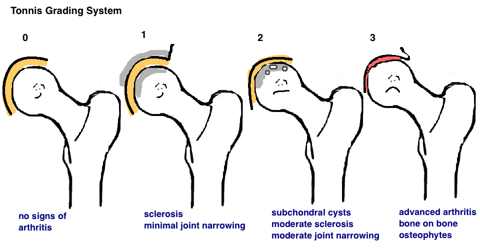 Hip Range of motion exercise - Samarpan Physiotherapy Clinic