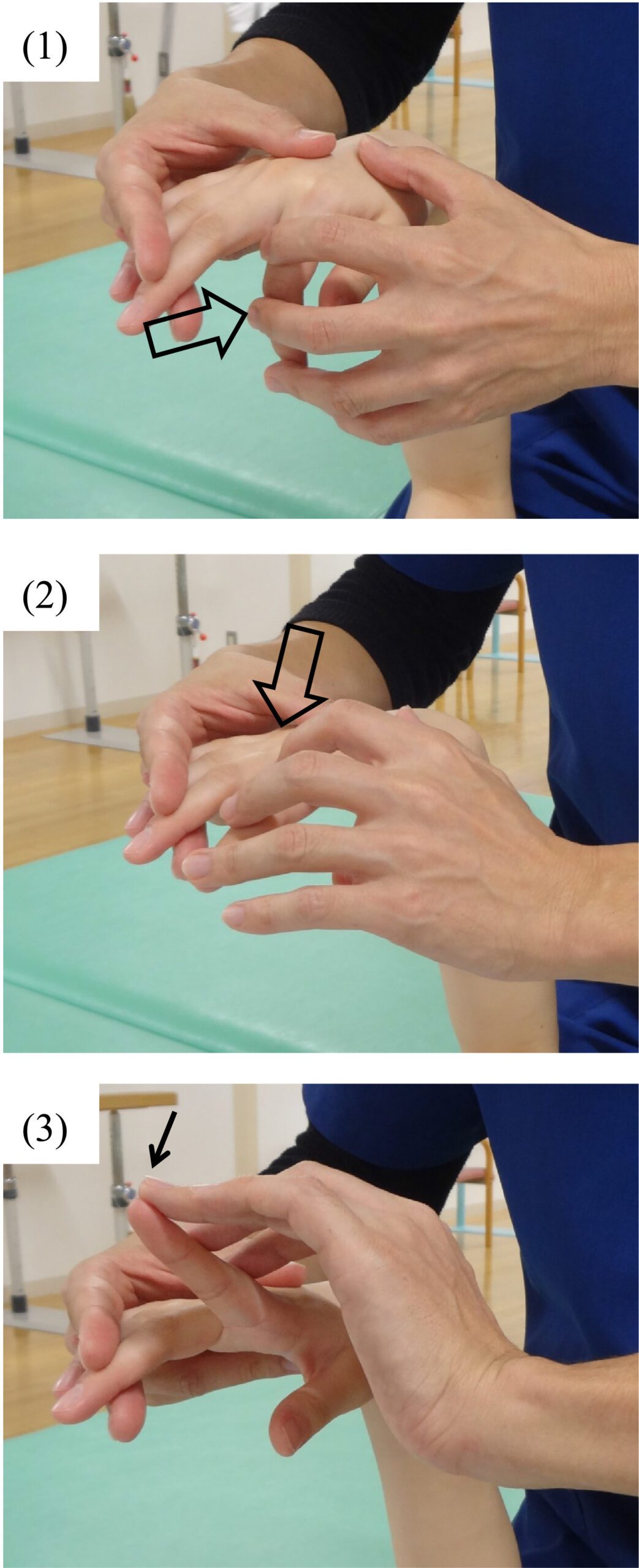 SPASTICITY IN HAND