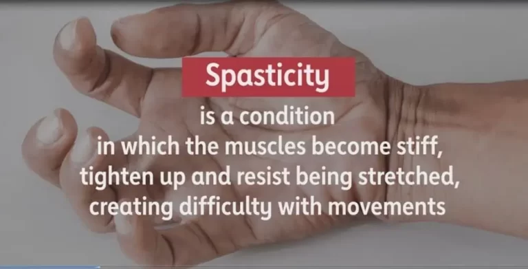 SPASTICITY IN HAND