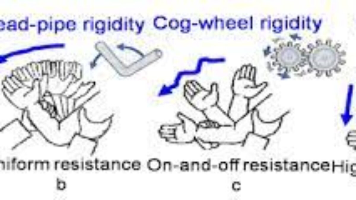 cogwheel-rigidity