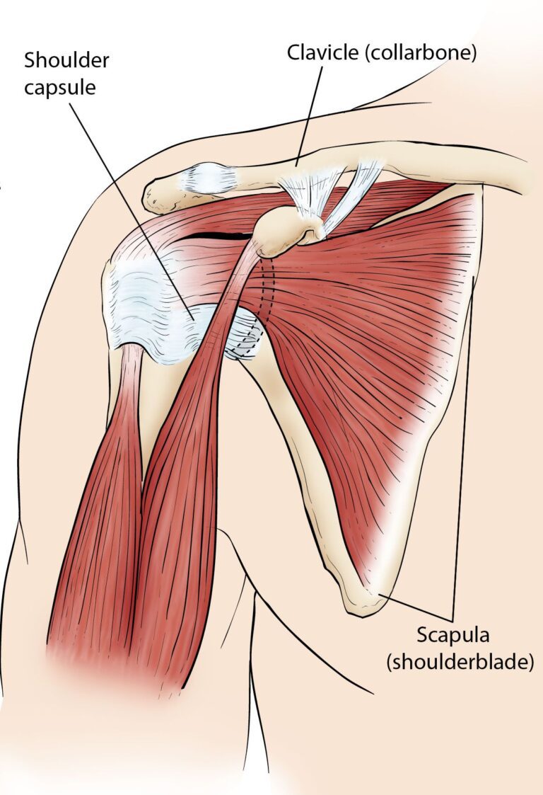 Frozen Shoulder Samarpan Physiotherapy Clinic